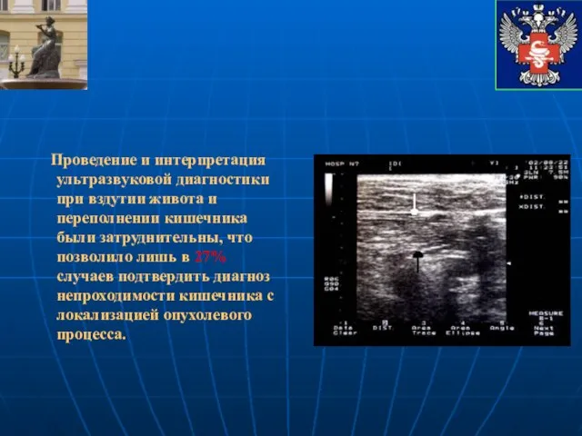 Проведение и интерпретация ультразвуковой диагностики при вздутии живота и переполнении кишечника были