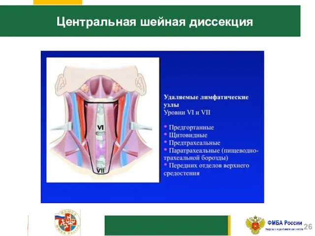 Центральная шейная диссекция