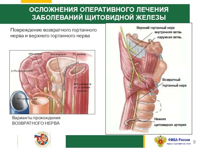 ОСЛОЖНЕНИЯ ОПЕРАТИВНОГО ЛЕЧЕНИЯ ЗАБОЛЕВАНИЙ ЩИТОВИДНОЙ ЖЕЛЕЗЫ Повреждение возвратного гортанного нерва и верхнего