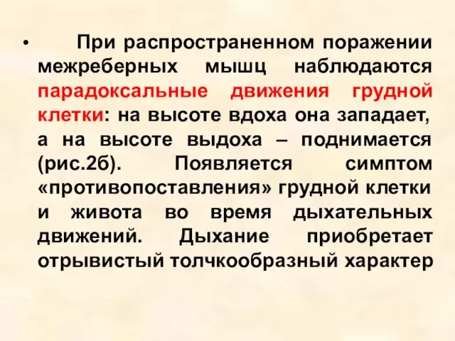 При распространенном поражении межреберных мышц наблюдаются парадоксальные движения грудной клетки: на высоте