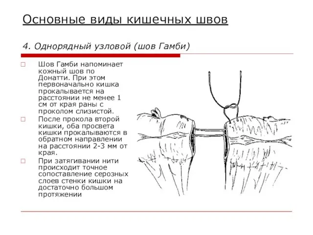 Основные виды кишечных швов 4. Однорядный узловой (шов Гамби) Шов Гамби напоминает