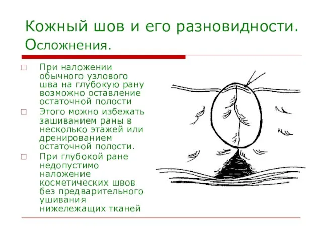 Кожный шов и его разновидности. Осложнения. При наложении обычного узлового шва на