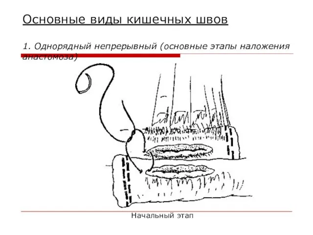 Основные виды кишечных швов 1. Однорядный непрерывный (основные этапы наложения анастомоза) Начальный этап