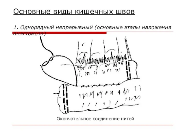 Основные виды кишечных швов 1. Однорядный непрерывный (основные этапы наложения анастомоза) Окончательное соединение нитей