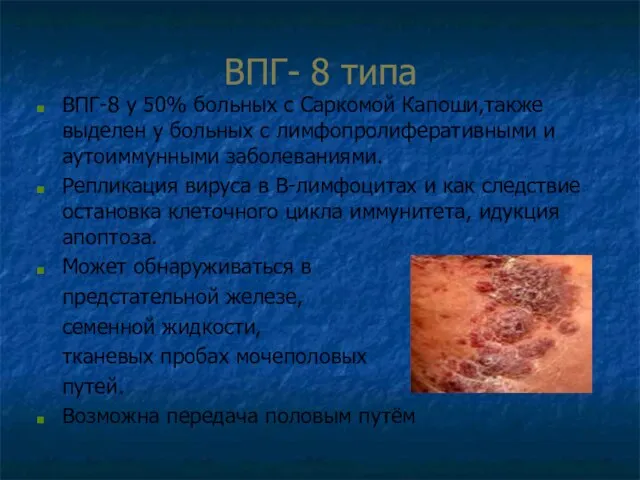 ВПГ- 8 типа ВПГ-8 у 50% больных с Саркомой Капоши,также выделен у