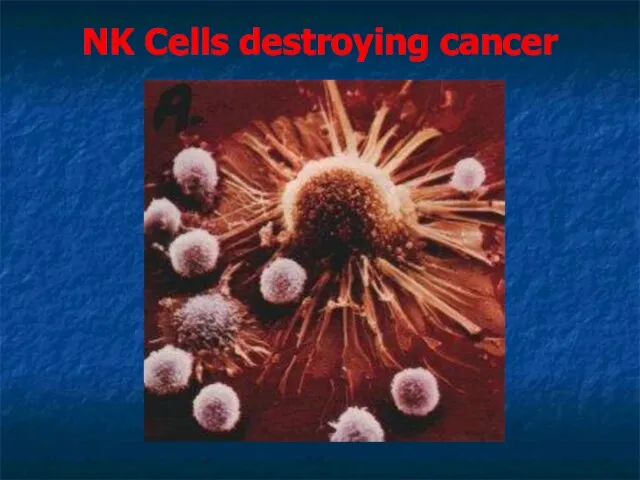 NK Cells destroying cancer