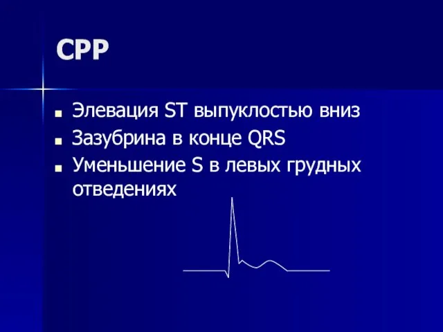 СРР Элевация ST выпуклостью вниз Зазубрина в конце QRS Уменьшение S в левых грудных отведениях