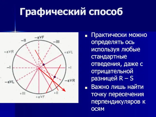 Графический способ Практически можно определять ось используя любые стандартные отведения, даже с