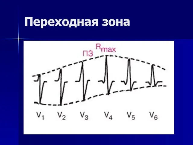 Переходная зона