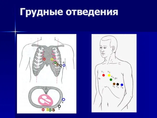 Грудные отведения