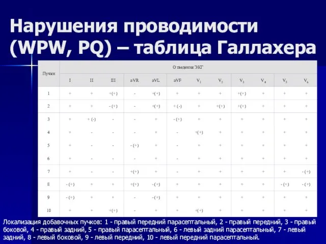 Нарушения проводимости (WPW, PQ) – таблица Галлахера Локализация добавочных пучков: 1 -