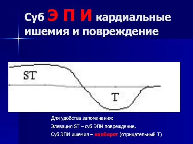 Суб Э П И кардиальные ишемия и повреждение Для удобства запоминания: Элевация