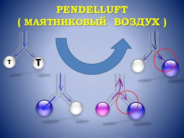 PENDELLUFT ( МАЯТНИКОВЫЙ ВОЗДУХ ) τ τ