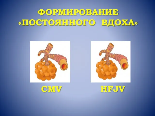 ФОРМИРОВАНИЕ «ПОСТОЯННОГО ВДОХА»