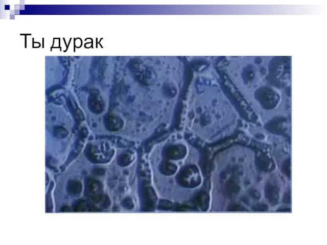 Ты дурак