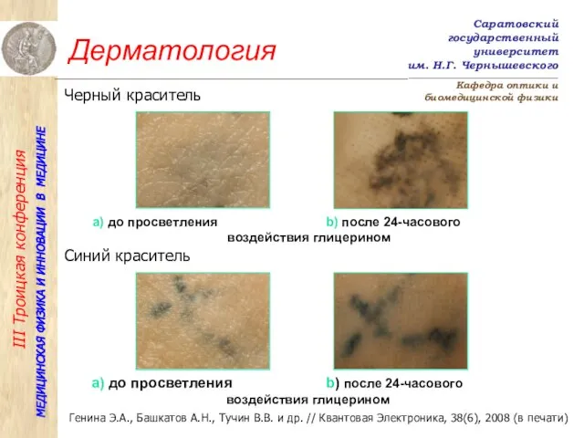 Дерматология Генина Э.А., Башкатов А.Н., Тучин В.В. и др. // Квантовая Электроника,