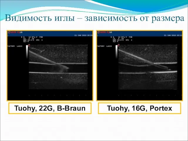 Видимость иглы – зависимость от размера Tuohy, 22G, B-Braun Tuohy, 16G, Portex