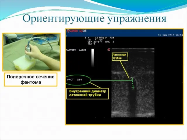 Ориентирующие упражнения Поперечное сечение фантома