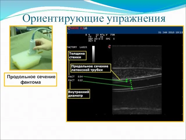 Ориентирующие упражнения Продольное сечение фантома