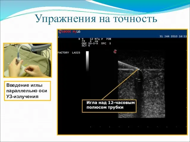 Упражнения на точность Введение иглы параллельно оси УЗ-излучения