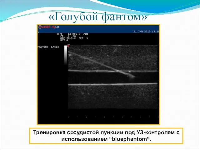 «Голубой фантом» Тренировка сосудистой пункции под УЗ-контролем с использованием “bluephantom”.