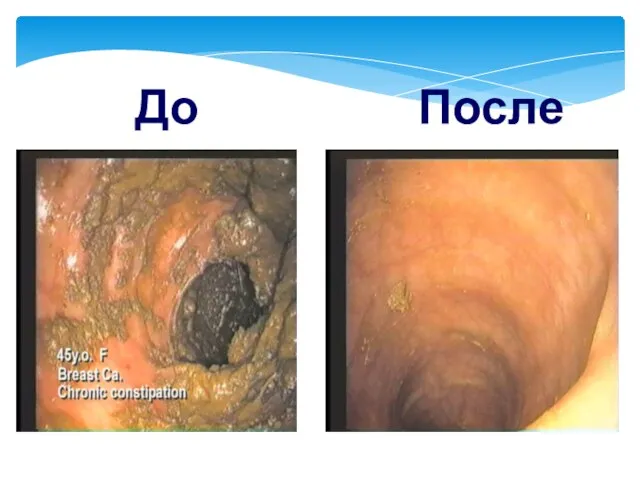 После До