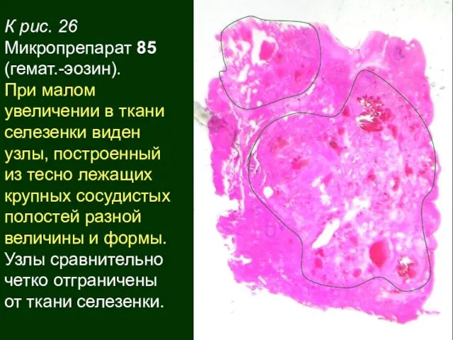 К рис. 26 Микропрепарат 85 (гемат.-эозин). При малом увеличении в ткани селезенки