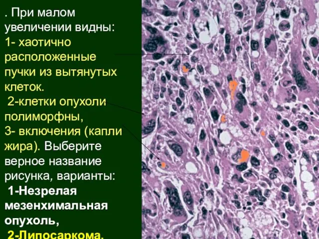 . При малом увеличении видны: 1- хаотично расположенные пучки из вытянутых клеток.