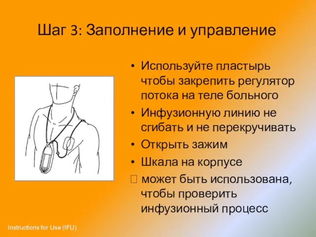 Шаг 3: Заполнение и управление Используйте пластырь чтобы закрепить регулятор потока на