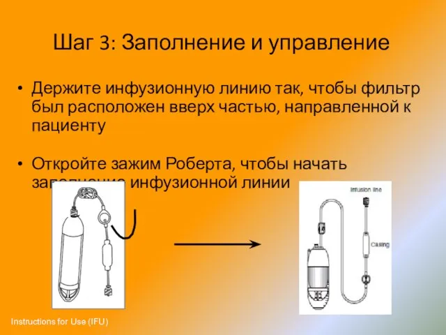 Шаг 3: Заполнение и управление Держите инфузионную линию так, чтобы фильтр был