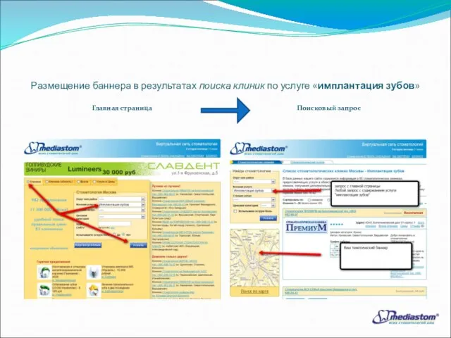 Размещение баннера в результатах поиска клиник по услуге «имплантация зубов» Главная страница Поисковый запрос