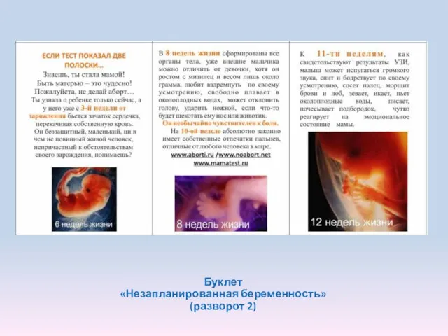 Буклет «Незапланированная беременность» (разворот 2)