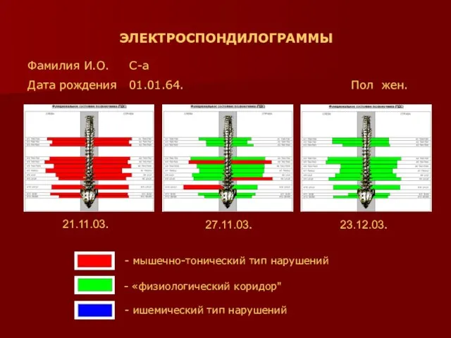 ЭЛЕКТРОСПОНДИЛОГРАММЫ Фамилия И.О. С-а Дата рождения 01.01.64. Пол жен. 21.11.03. 27.11.03. 23.12.03.