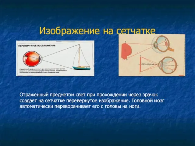 Изображение на сетчатке Отраженный предметом свет при прохождении через зрачок создает на