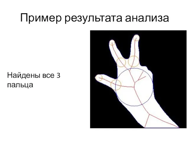 Пример результата анализа Найдены все 3 пальца