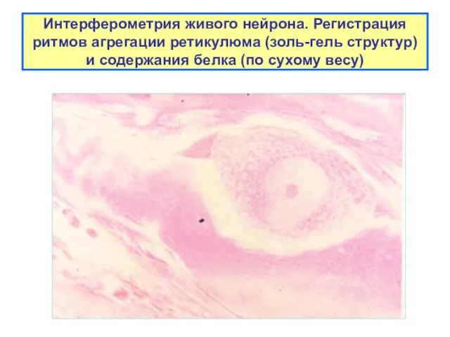 Интерферометрия живого нейрона. Регистрация ритмов агрегации ретикулюма (золь-гель структур) и содержания белка (по сухому весу)