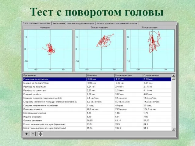 Тест с поворотом головы