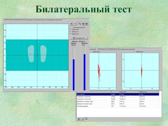 Билатеральный тест