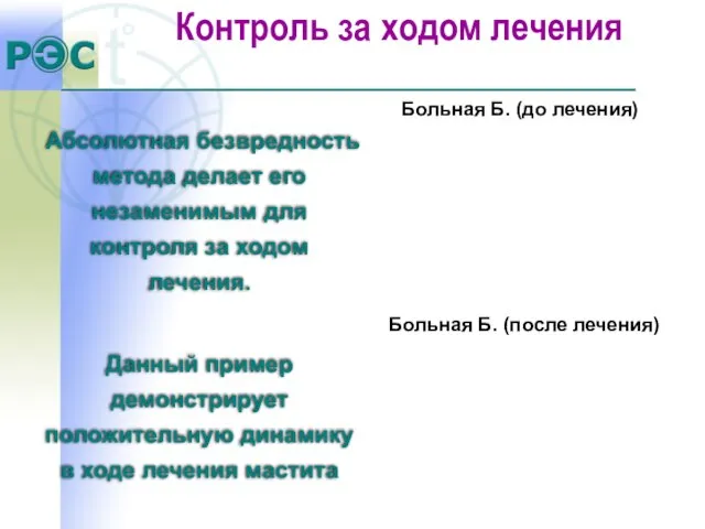 Абсолютная безвредность метода делает его незаменимым для контроля за ходом лечения. Больная