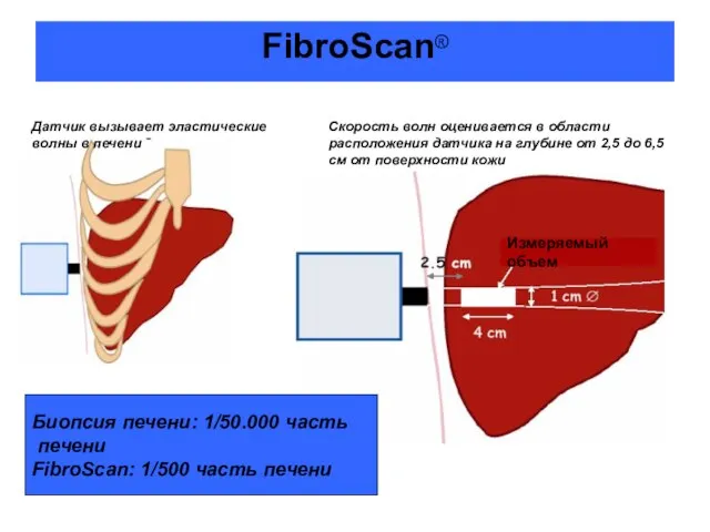 FibroScan® Датчик вызывает эластические волны в печени Скорость волн оценивается в области