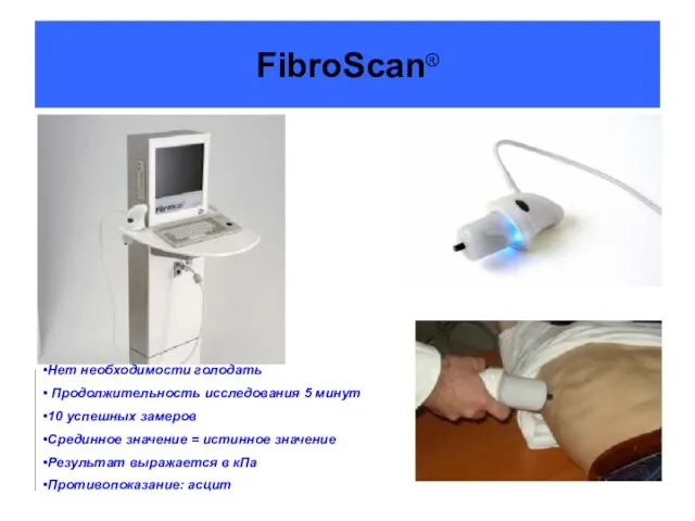 FibroScan® Нет необходимости голодать Продолжительность исследования 5 минут 10 успешных замеров Срединное