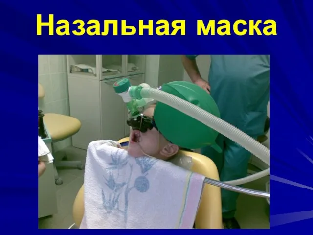 Назальная маска