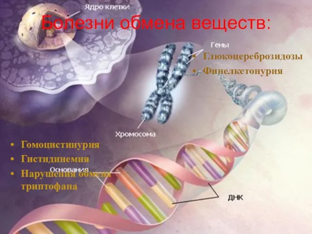 Болезни обмена веществ: Гомоцистинурия Гистидинемия Нарушения обмена триптофана Глюкоцереброзидозы Финелкетонурия