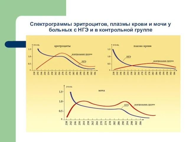 Спектрограммы эритроцитов, плазмы крови и мочи у больных с НГЭ и в контрольной группе