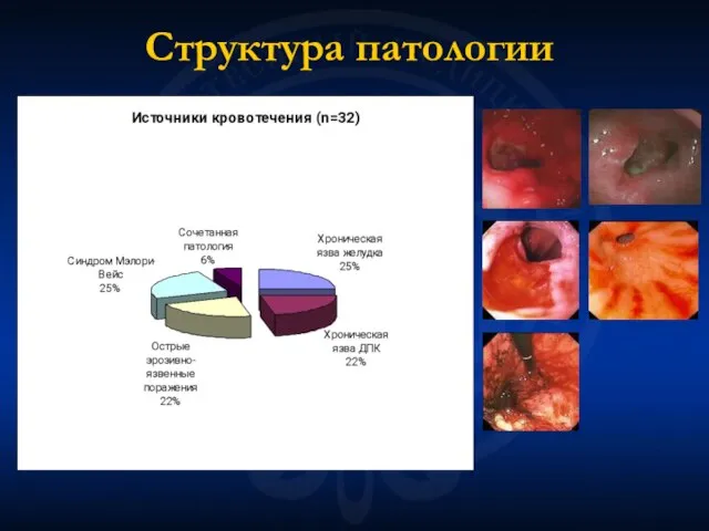 Структура патологии