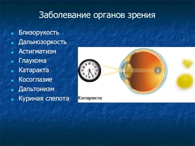 Заболевание органов зрения Близорукость Дальнозоркость Астигматизм Глаукома Катаракта Косоглазие Дальтонизм Куриная слепота