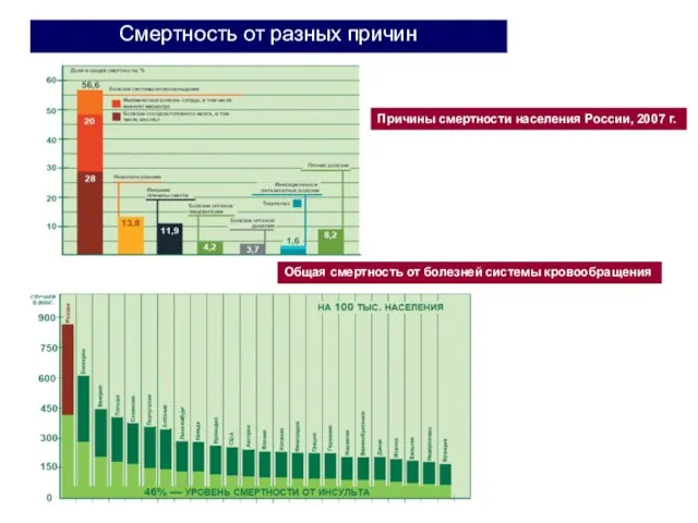 Смертность от разных причин Причины смертности населения России, 2007 г. Общая смертность от болезней системы кровообращения