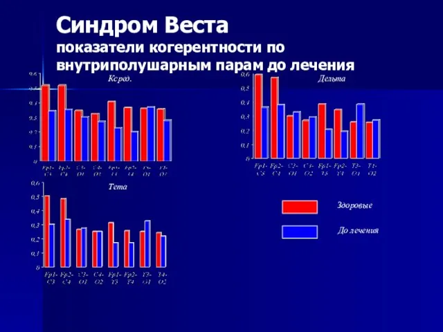 Синдром Веста показатели когерентности по внутриполушарным парам до лечения