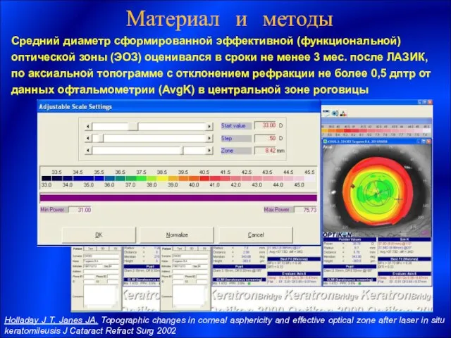 Средний диаметр сформированной эффективной (функциональной) оптической зоны (ЭОЗ) оценивался в сроки не