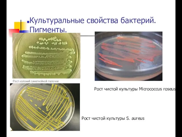 Культуральные свойства бактерий. Пигменты. Рост чистой культуры Micrococcus roseus. Рост чистой культуры S. aureus